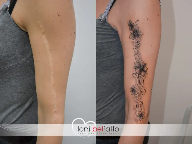 Cicatrice coperta con un tatuaggio artistico, prima e dopo