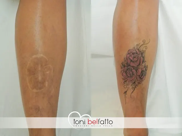 Cicatrice coperta con un tatuaggio artistico, prima e dopo