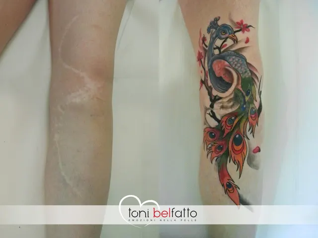 Cicatrice coperta con un tatuaggio artistico, prima e dopo