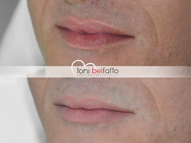 Trucco permanente delle labbra, prima e dopo