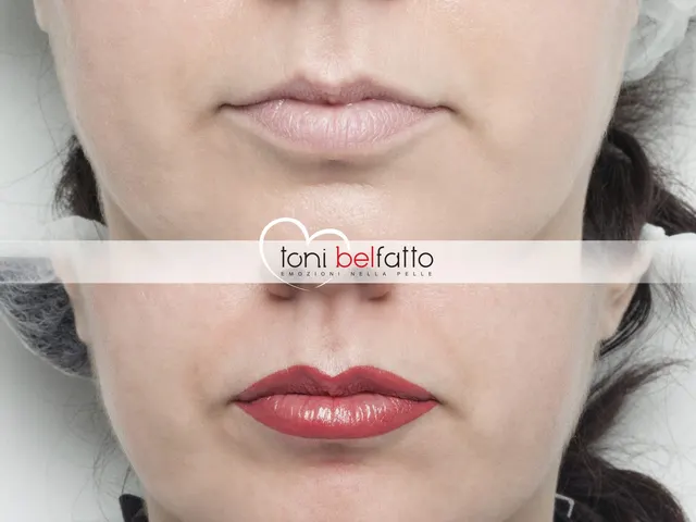 Trucco permanente delle labbra, prima e dopo