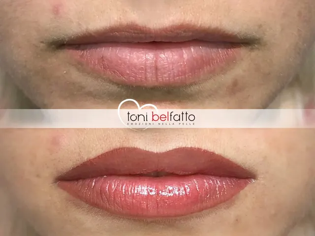 Trucco permanente delle labbra, prima e dopo