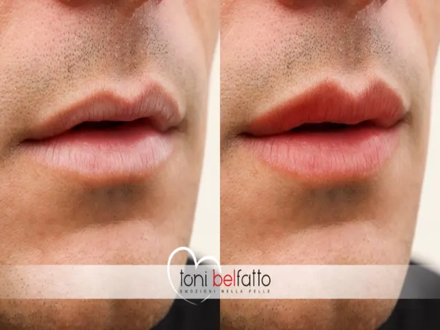 Trucco permanente delle labbra su un uomo, prima e dopo