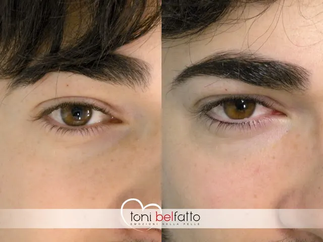 Eyeliner in trucco permanente, prima e dopo