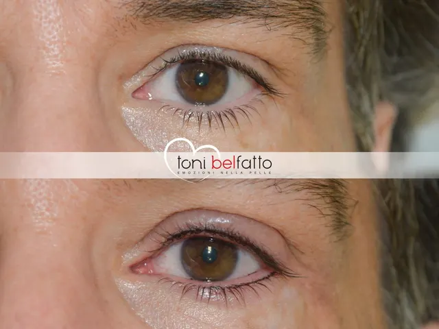 Eyeliner in trucco permanente, prima e dopo